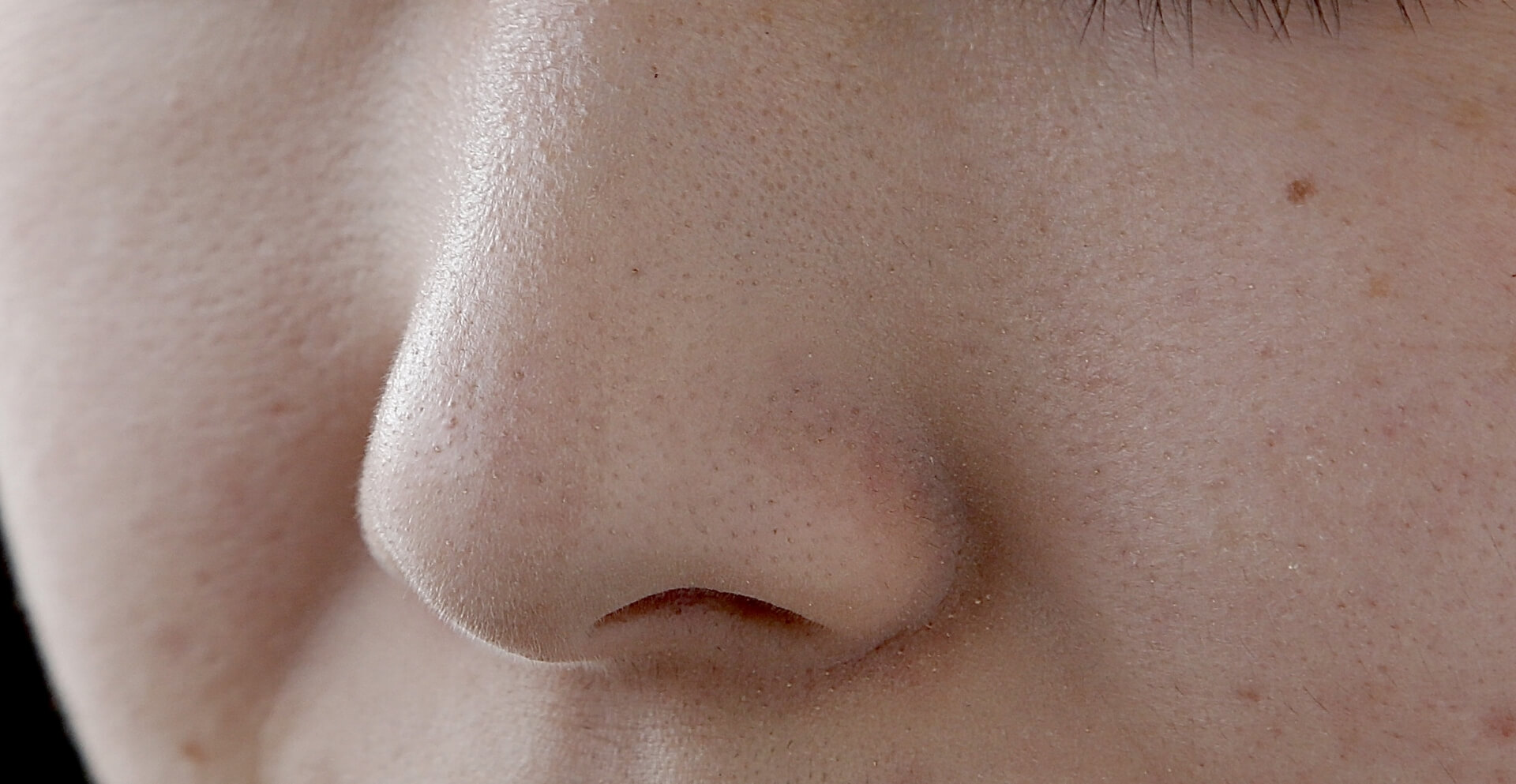 毛穴の黒ずみが発生する主な原因とは？角栓や皮脂の影響を解説