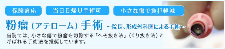 粉瘤（アテローム）手術[保険適応][当日日帰り手術可][小さな傷で負担軽減] 当院では、小さな傷で粉瘤を切除する「へそ抜き法」（くり抜き法）と呼ばれる手術法を推奨しています。